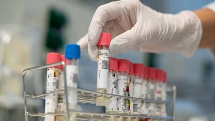 Diaz confirmó el primer caso de coronavirus y aguarda otro hisopado
